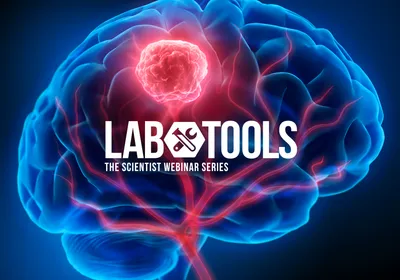 Viewing the Glioblastoma Tumor Microenvironment at Single Cell Resolution